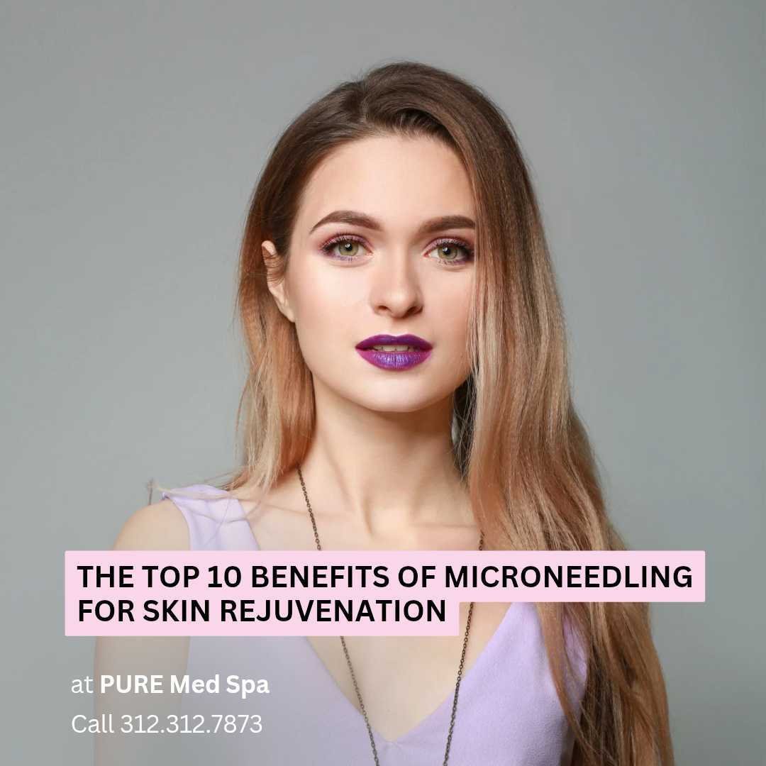 The Top 10 Benefits of Microneedling for Skin Rejuvenation