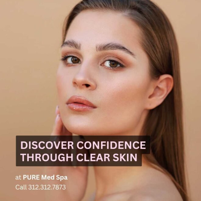 Discover Confidence Through Clear Skin