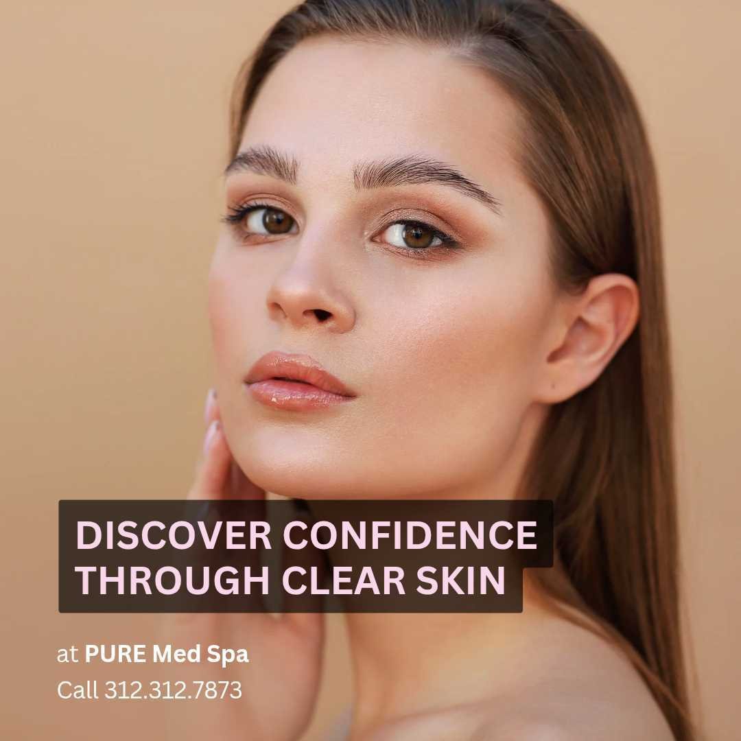 Discover Confidence Through Clear Skin Discover Confidence Through Clear Skin