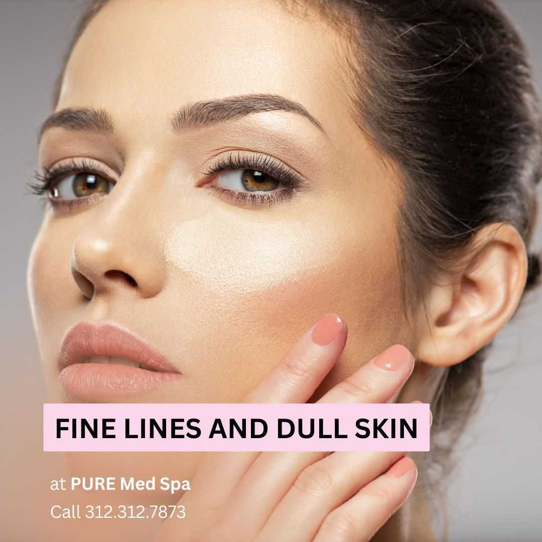 Fine Lines and Dull Skin. Fine Lines and Dull Skin.