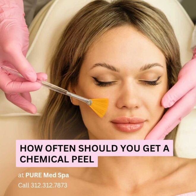 How Often Should You Get a Chemical Peel.
