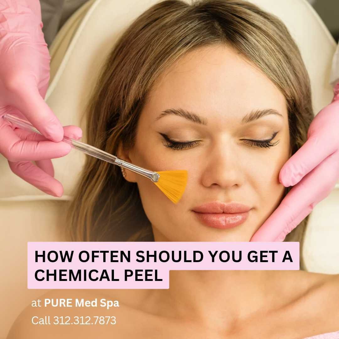 How Often Should You Get a Chemical Peel. How Often Should You Get a Chemical Peel.