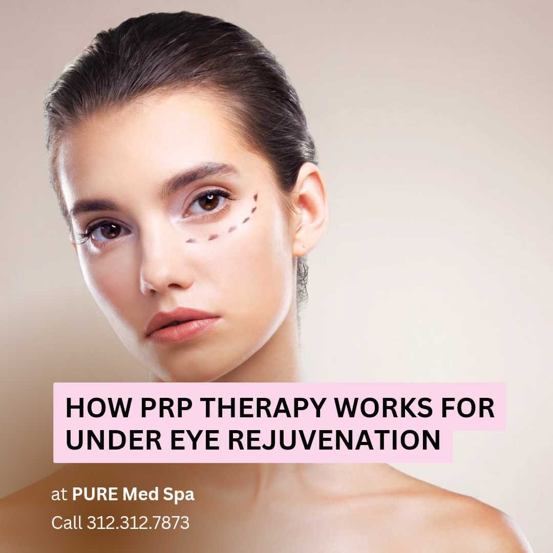 How PRP Therapy Works for Under Eye Rejuvenation How PRP Therapy Works for Under Eye Rejuvenation