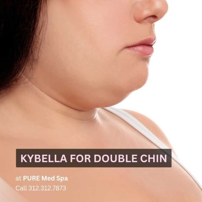 Kybella for Double Chin