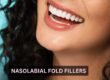 Nasolabial Fold Fillers
