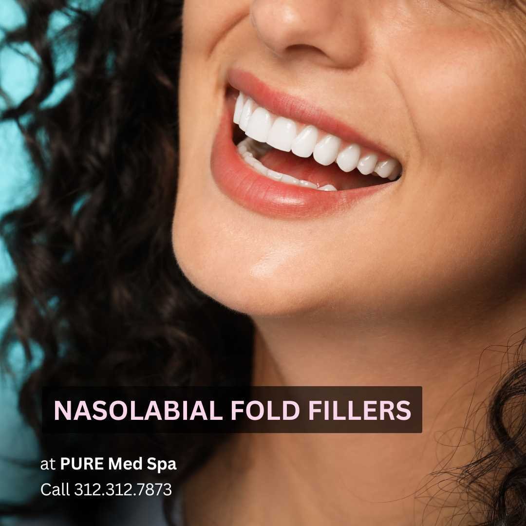 Nasolabial Fold Fillers Nasolabial Fold Fillers