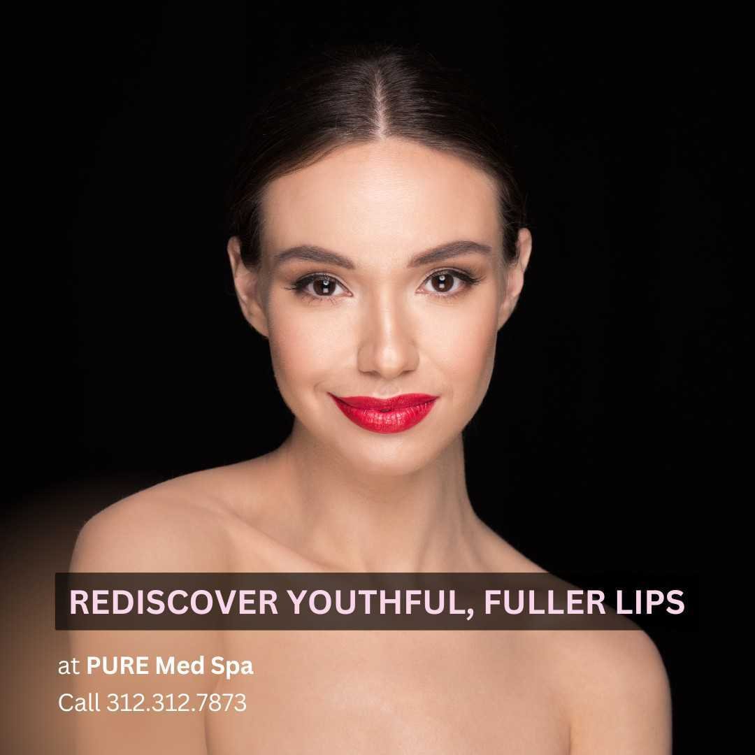 Rediscover Youthful, Fuller Lips Rediscover Youthful, Fuller Lips