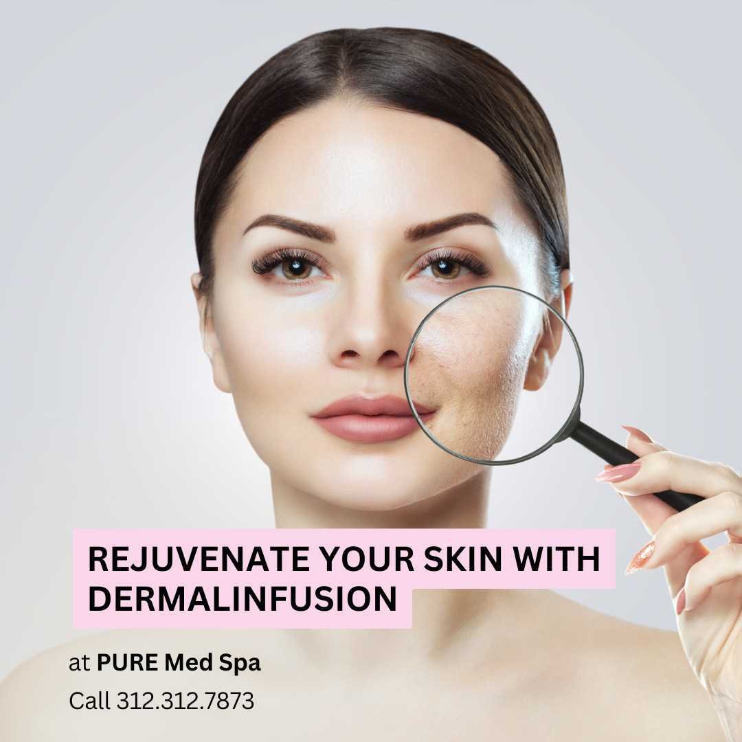 Rejuvenate Your Skin with Dermalinfusion Rejuvenate Your Skin with Dermalinfusion