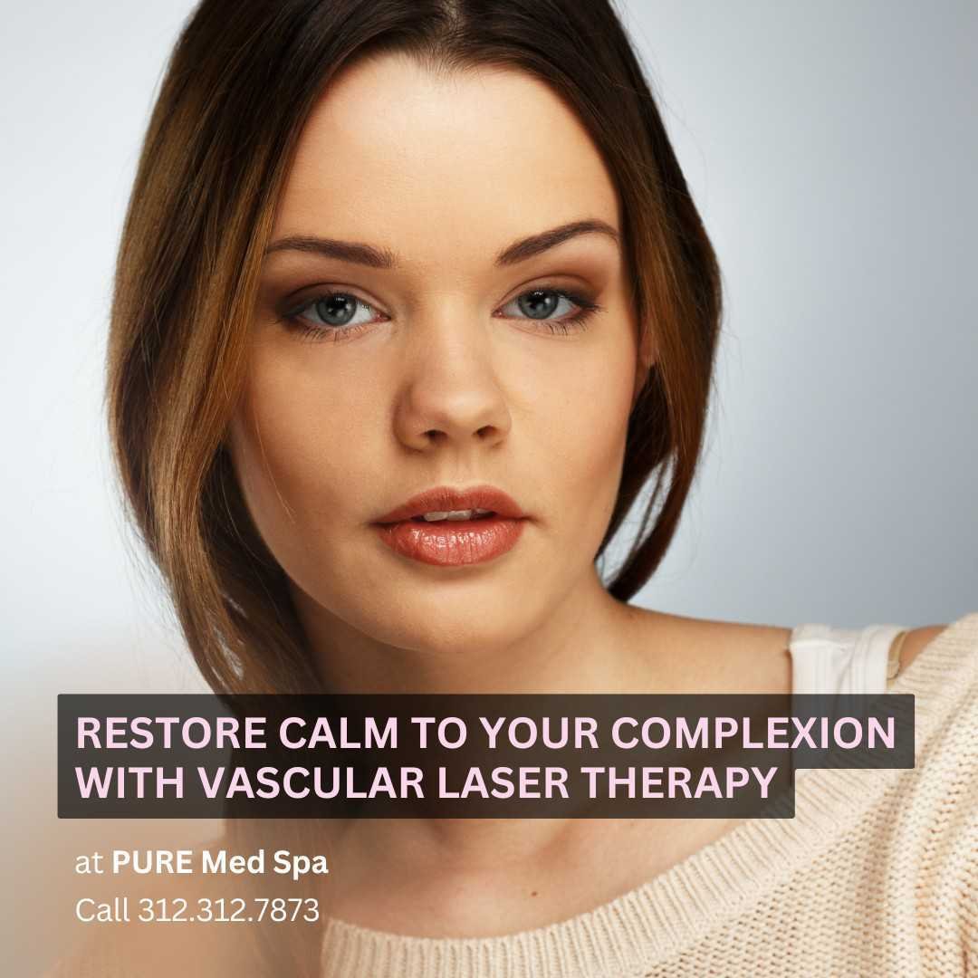 Restore Calm to Your Complexion Restore Calm to Your Complexion