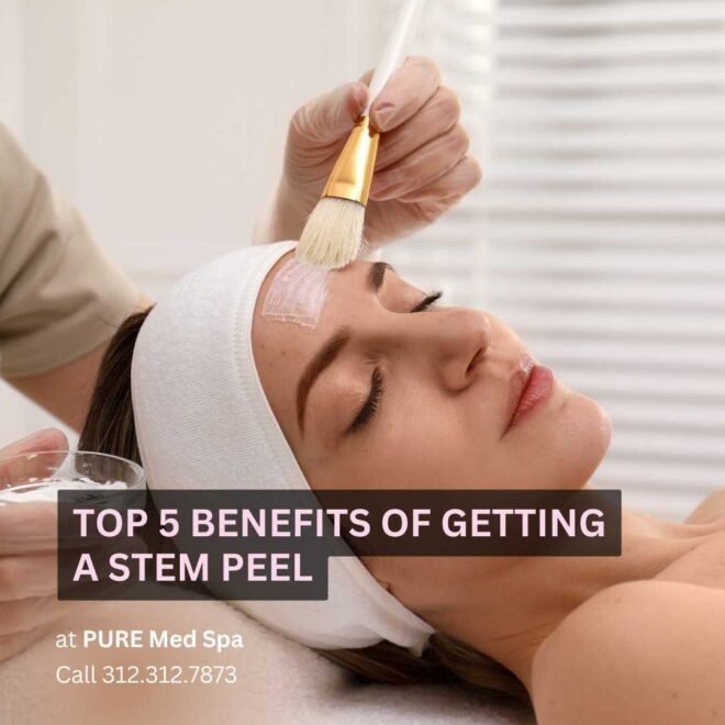 Top 5 Benefits of Getting a Stem Peel