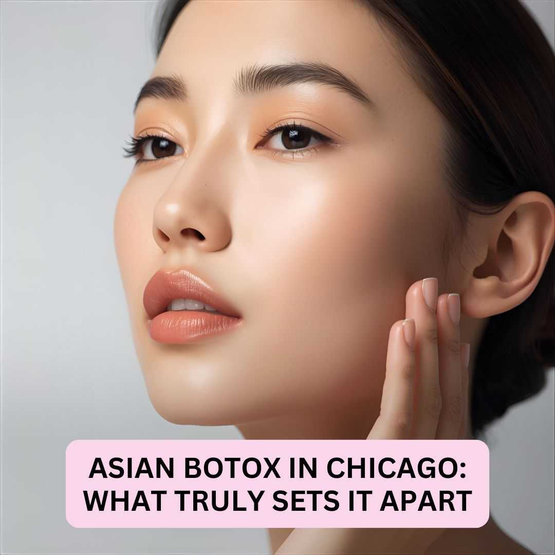 Asian Botox in Chicago What Truly Sets It Apart Asian Botox in Chicago What Truly Sets It Apart