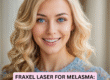 Fraxel Laser for Melasma.