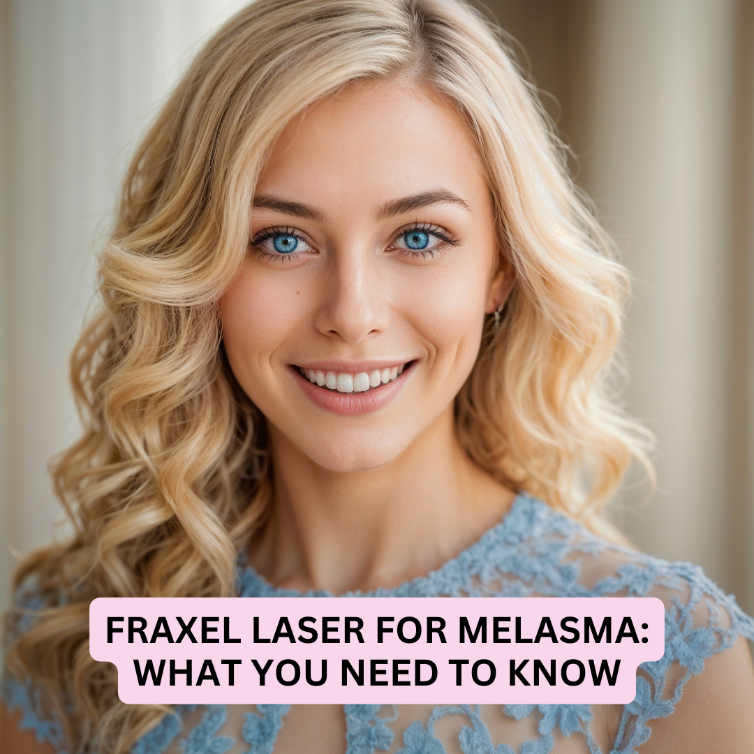 Fraxel Laser for Melasma. Fraxel Laser for Melasma.