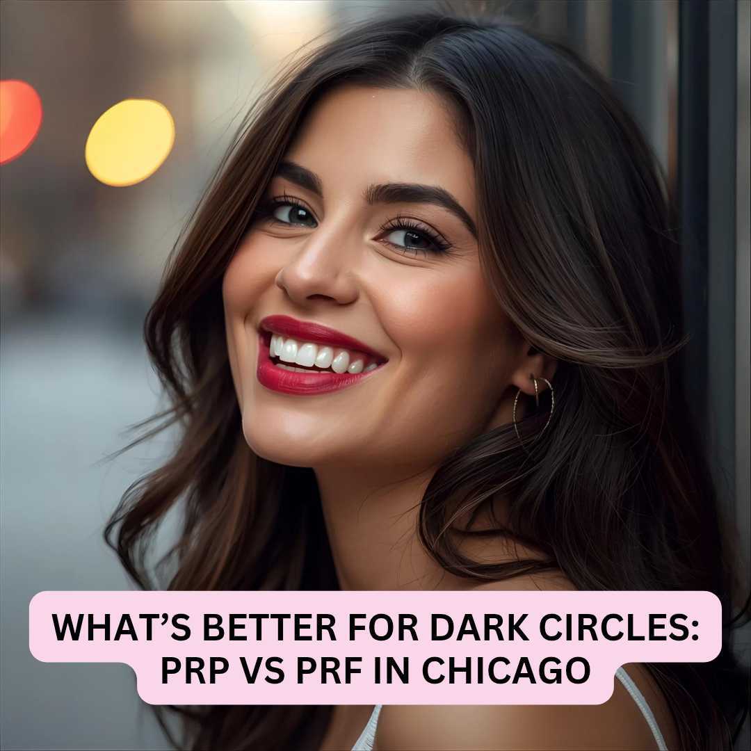 What’s Better for Dark Circles PRP vs PRF in Chicago What’s Better for Dark Circles PRP vs PRF in Chicago
