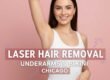 Laser Hair Removal for Underarms & Bikini in Chicago Quick Facts and FAQs