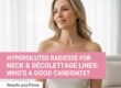 Radiesse for Neck