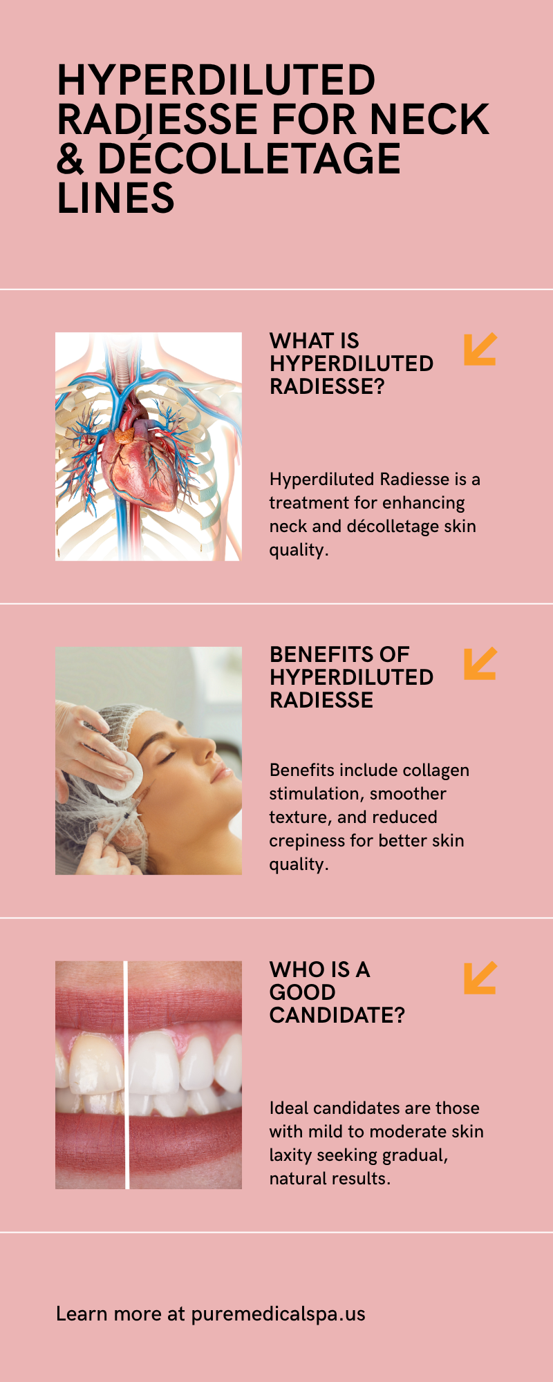 decolletage lines