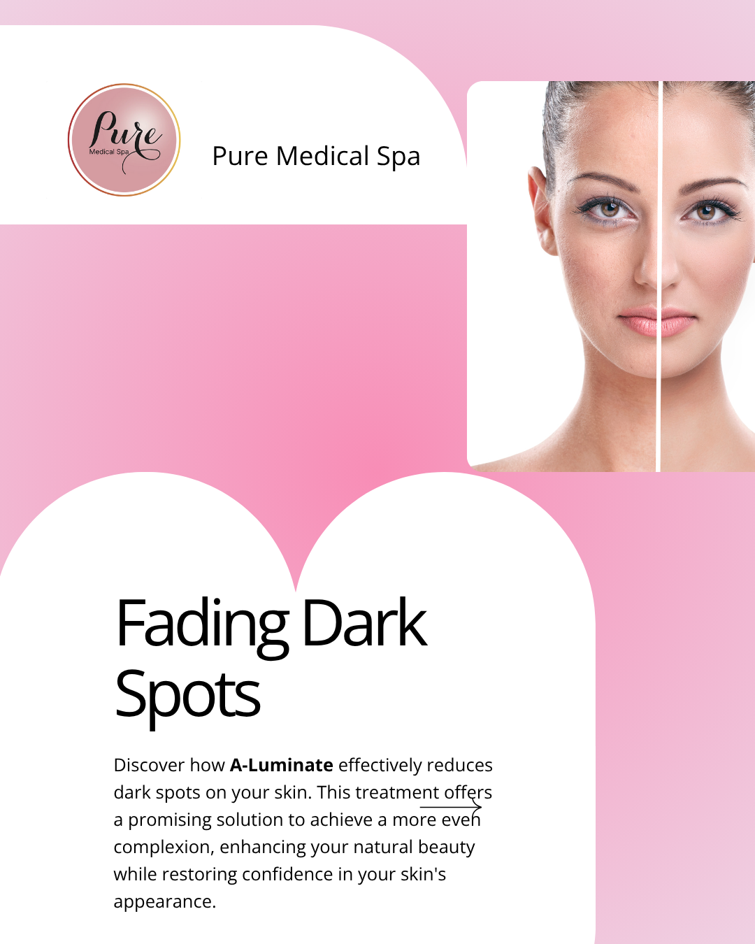 Fading Dark Spots