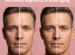 microdosing neuromodulators for men