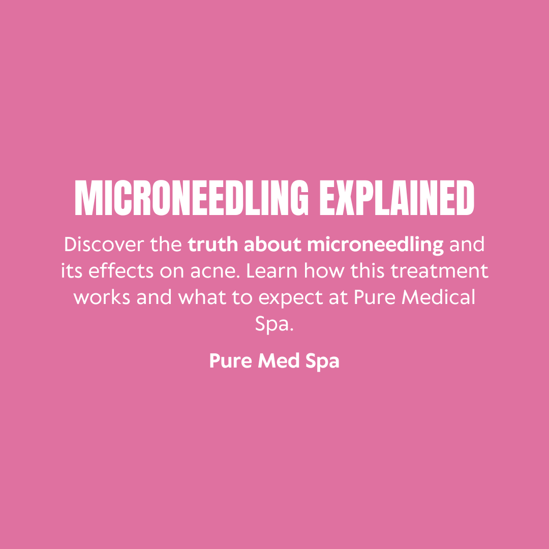 Microneedling Explained 