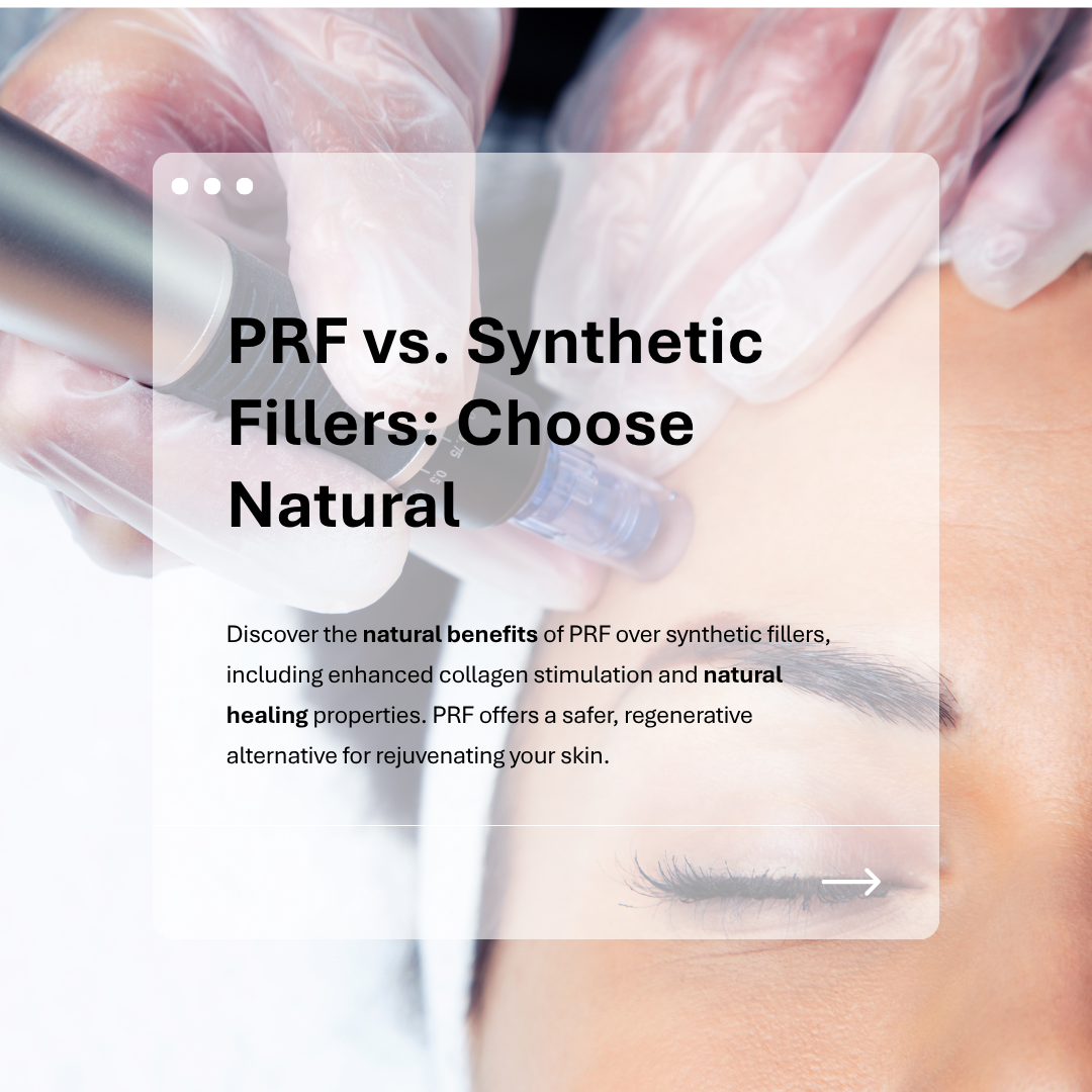 PRF vs Synthetic Fillers