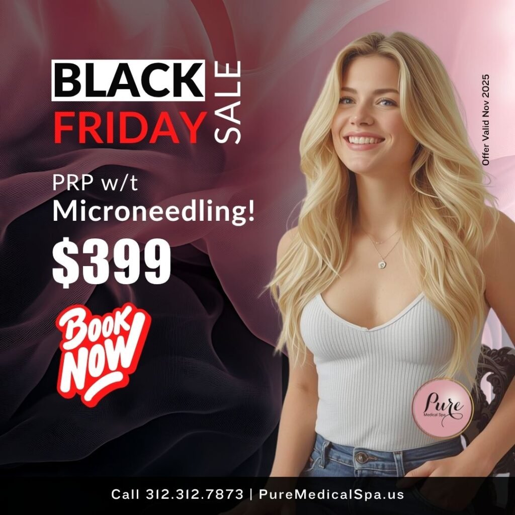 PRP wt Microneedling PRP wt Microneedling