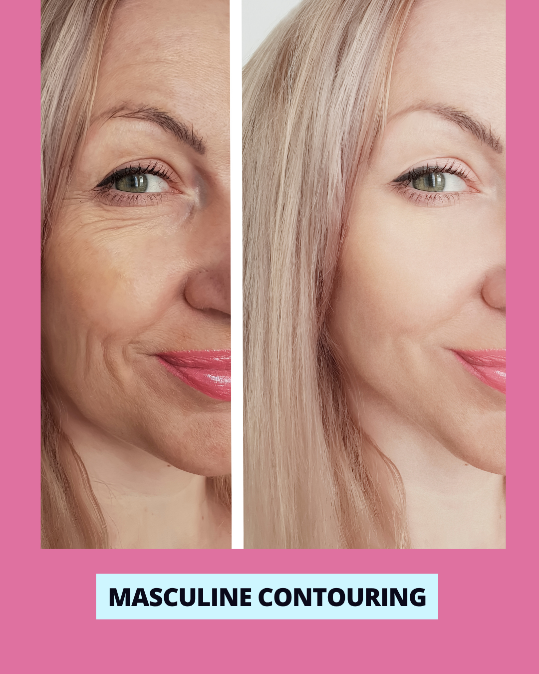 Masculine Facial Contouring