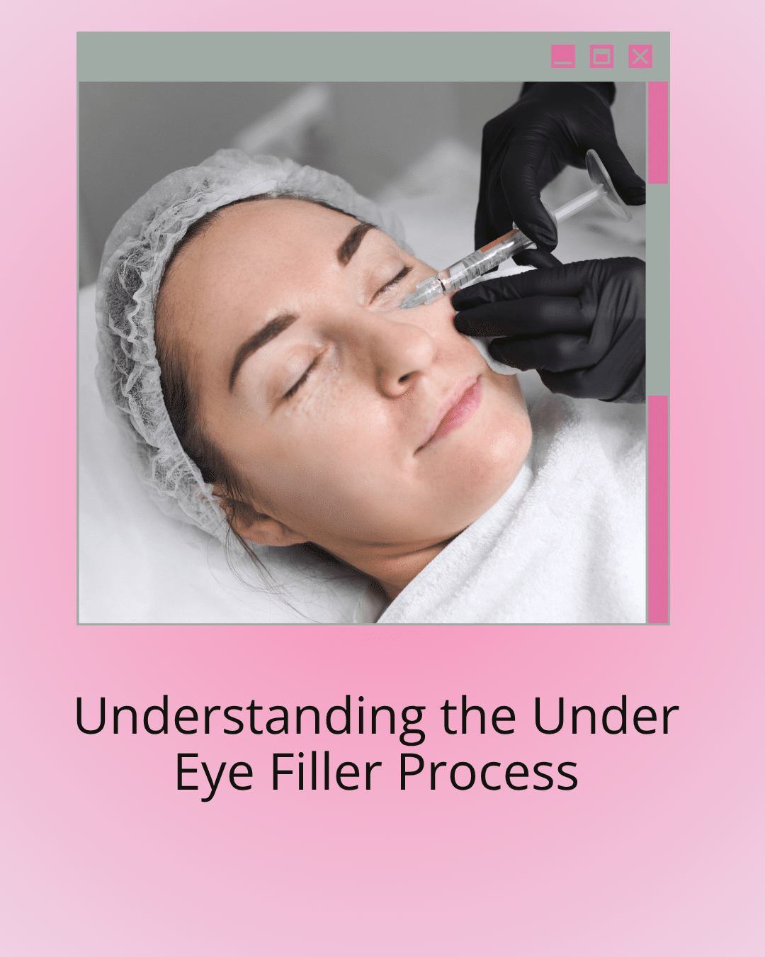 Understanding the Under Eye Filler Process