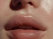 PRF for Lips, Natural Lip Enhancement Without Fillers