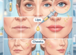 The Ultimate Guide to PRF, Under-Eye, Lips, and Cheeks Rejuvenation