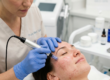 Why Microneedling for Acne Scars Works Better