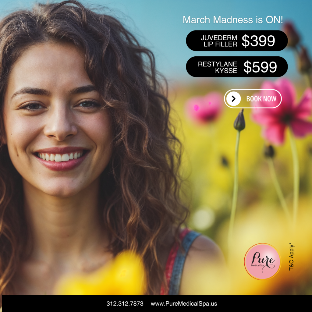 pure-chicago-lip-filler-399-kysse-599-march-2026