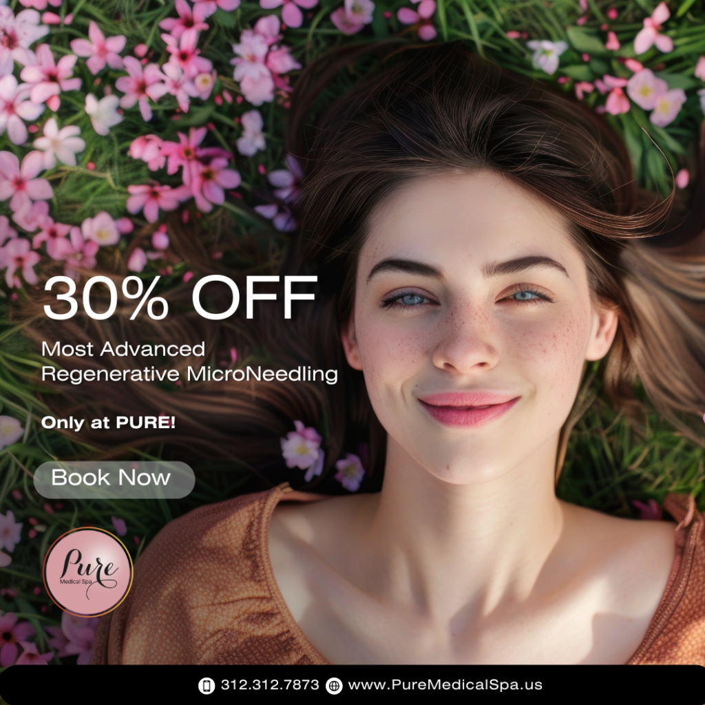 30_ OFF MicroNeedling , Monthly Offer, April 2026 30_ OFF MicroNeedling , Monthly Offer, April 2026