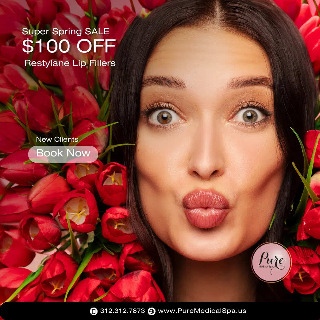 $100 off Restylane lip fillers for new clients, Super Spring Sale at Pure Medical Spa, med spa in Chicago