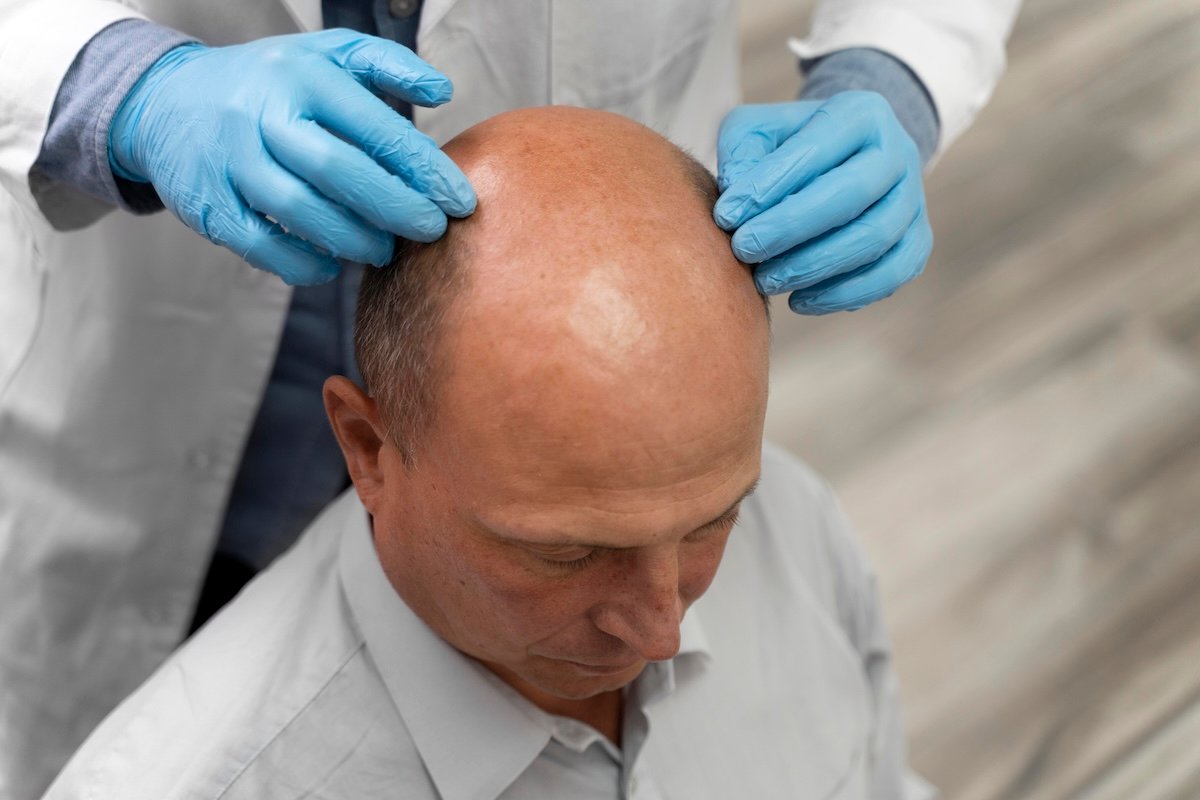 PURE Hair ReGrow NeoGraft FUE hair transplant Chicago