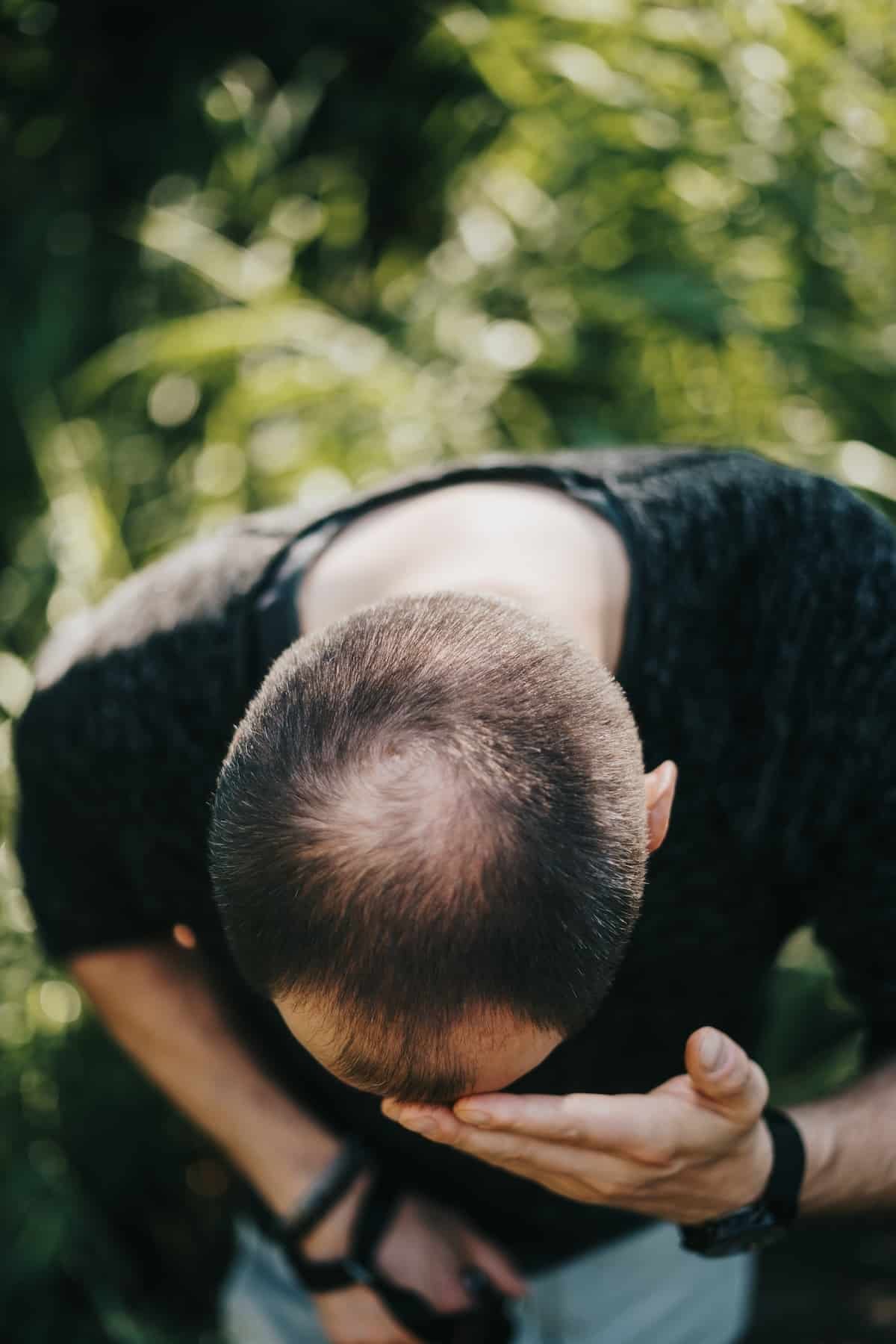 Man noticing a receding hairline and crown thinning in Chicago