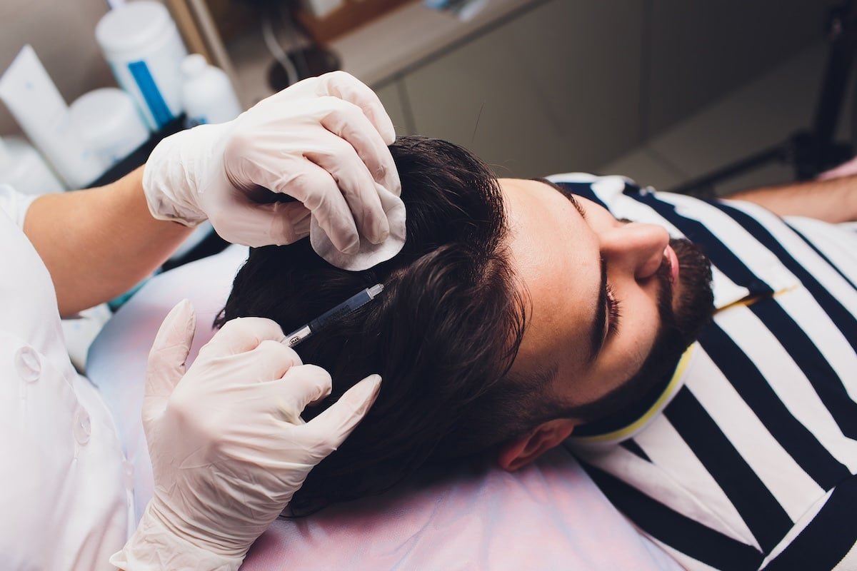 Person noticing increased hair shedding and thinning in Chicago