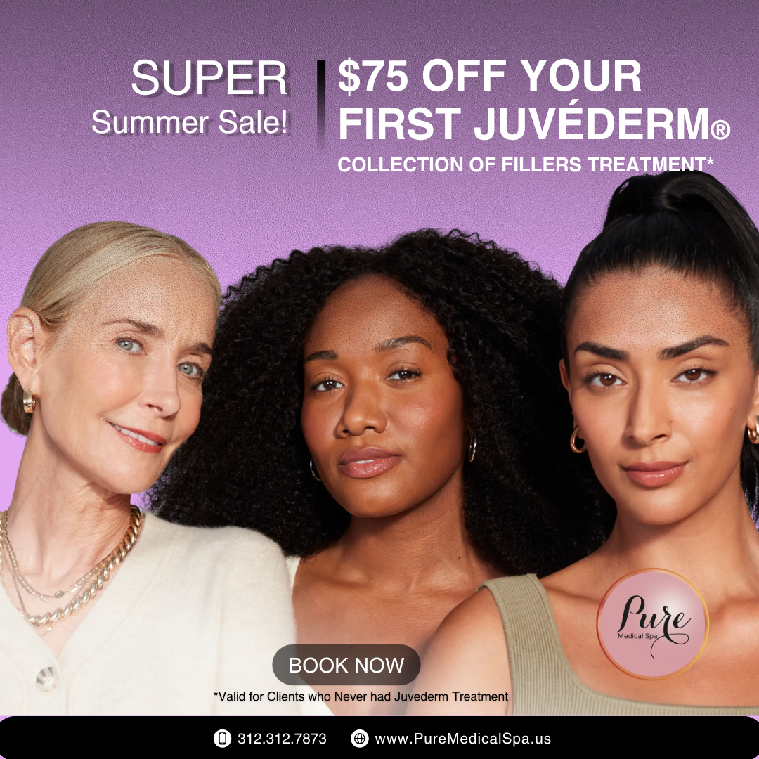 75-OFF-juvederm-lip-fillers $75 off first Juvederm lip filler treatment at PURE Medical Spa Chicago, natural fuller lips offer via Alle