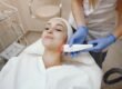 IPL for sunspots