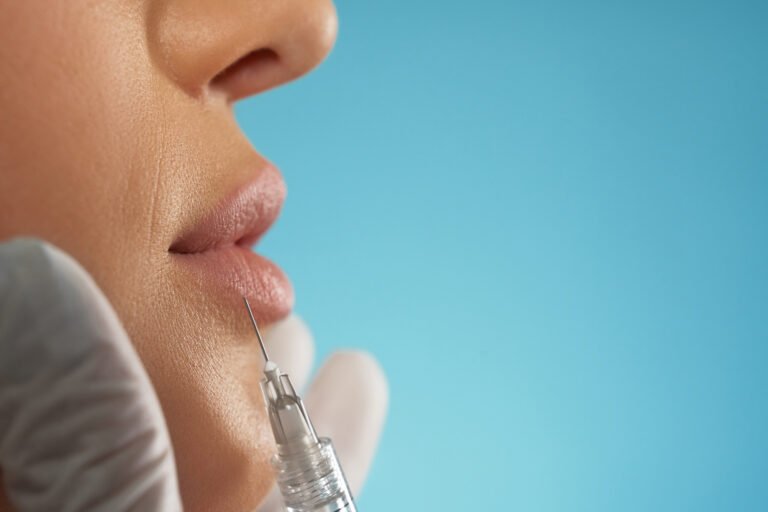 Botox for Lip Lines in Chicago Injector placing a small Botox dose near the upper lip to soften vertical lip lines