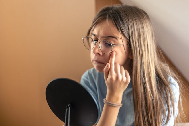 Breakouts After Dermalinfusion in Chicago Young woman checking her skin for breakouts in a hand mirror