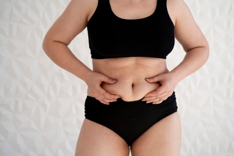 Woman pinching lower belly fat that CoolSculpting can target