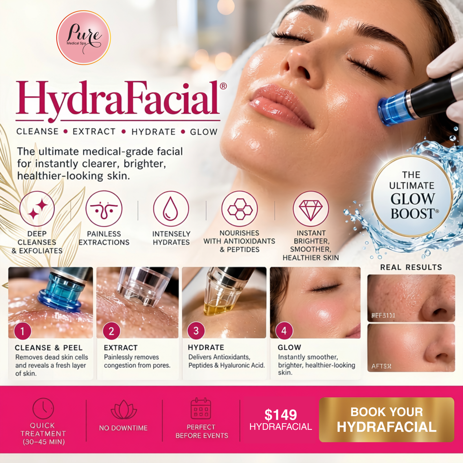 hydrafacial-149
