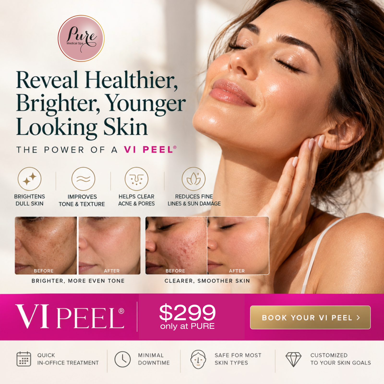 vi-peels-299-chicago